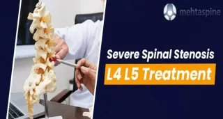Effective L4-L5 Spinal Stenosis Treatment | Mehta Spine