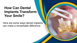 What Are The Best Dental Implants In Los Angeles?