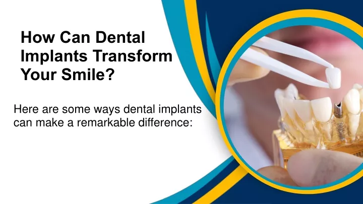 how can dental implants transform your smile