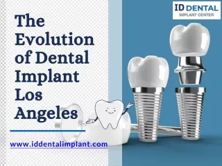 The Evolution of Dental Implant Los Angeles  ID Dental and Implant Center