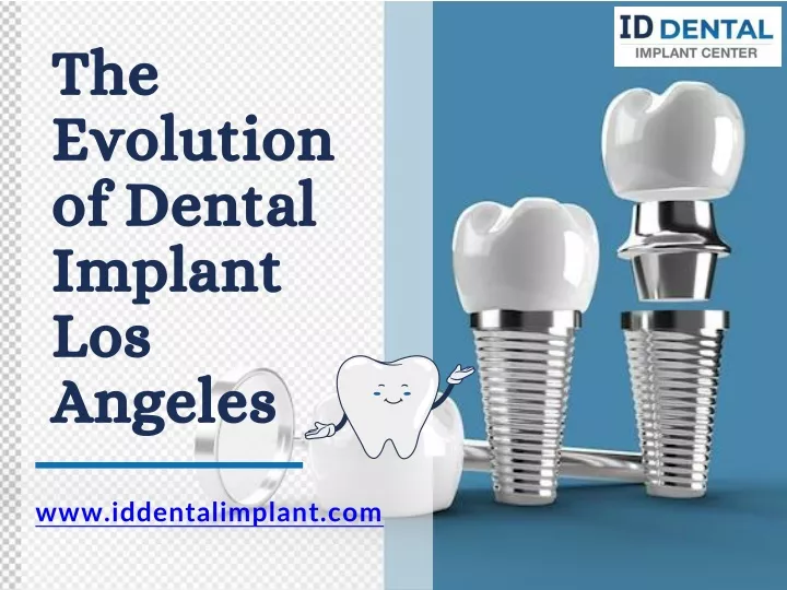 the evolution of dental implant los angeles