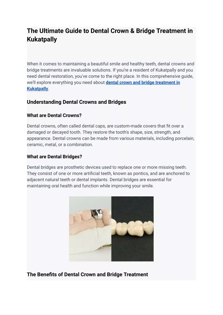 the ultimate guide to dental crown bridge