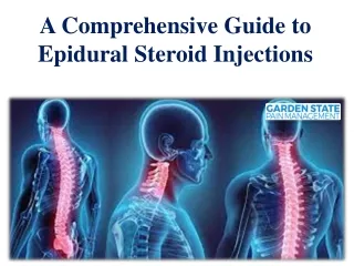 A Comprehensive Guide to Epidural Steroid Injections