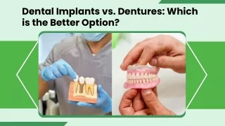 Dental Implants vs. Dentures: Which is the Better Option?