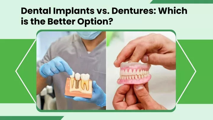 dental implants vs dentures which is the better