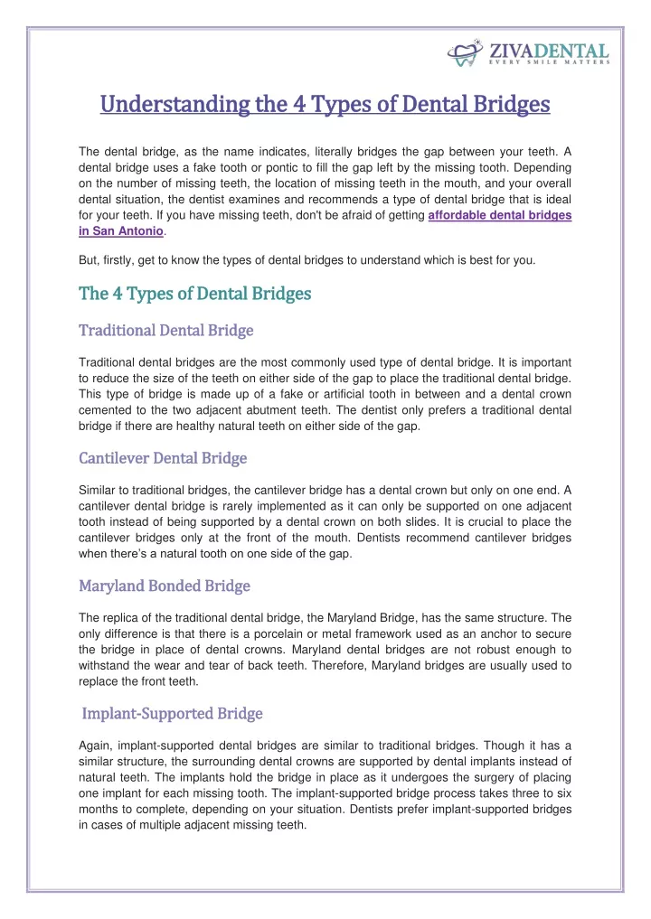 understanding the 4 types of dental bridges