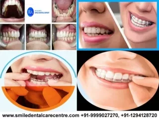 Best Dental Clinic in Faridabad For Orthodontic Treatment And Other Oral Treatme