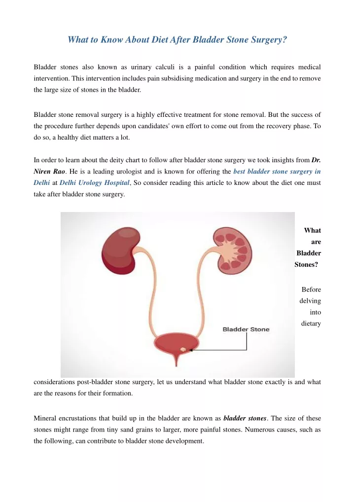 what to know about diet after bladder stone