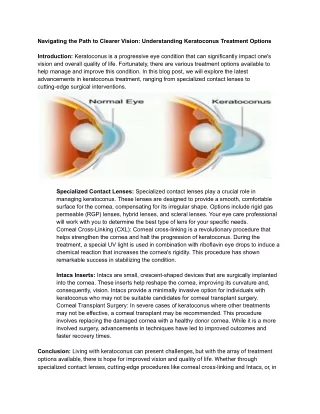 Navigating the Path to Clearer Vision (1)