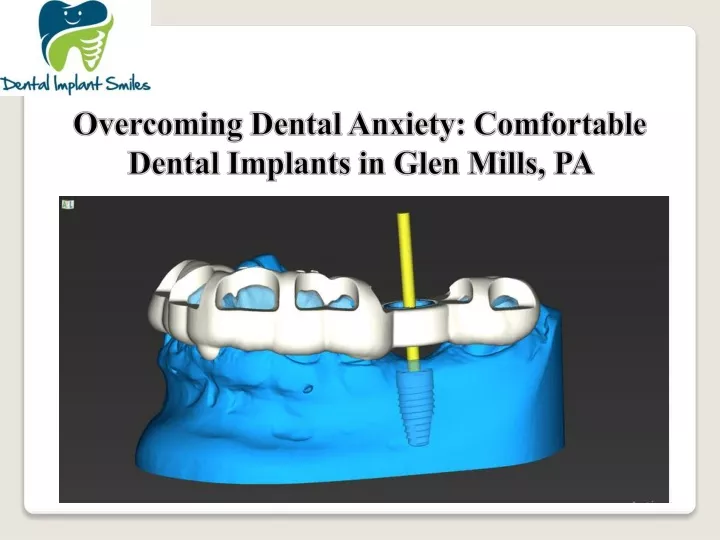 overcoming dental anxiety comfortable dental