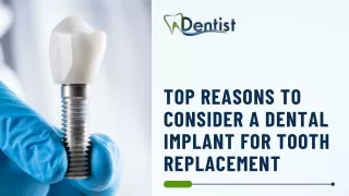 Discover the Top Reasons to Choose Dental Implants for Tooth Replacement