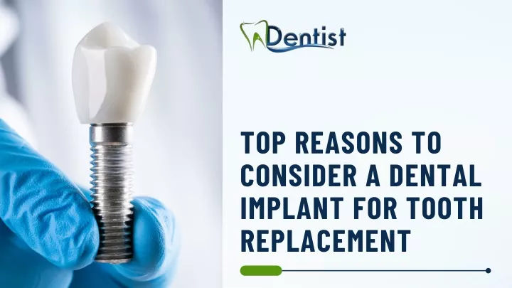 top reasons to consider a dental implant
