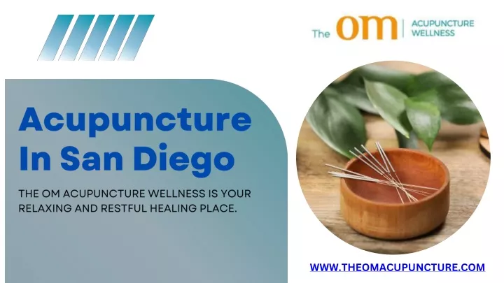 acupuncture in san diego