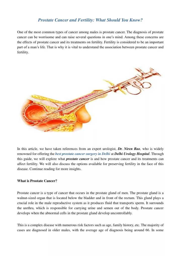 prostate cancer and fertility what should