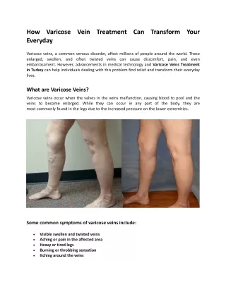 How Varicose Vein Treatment Can Transform Your Everyday
