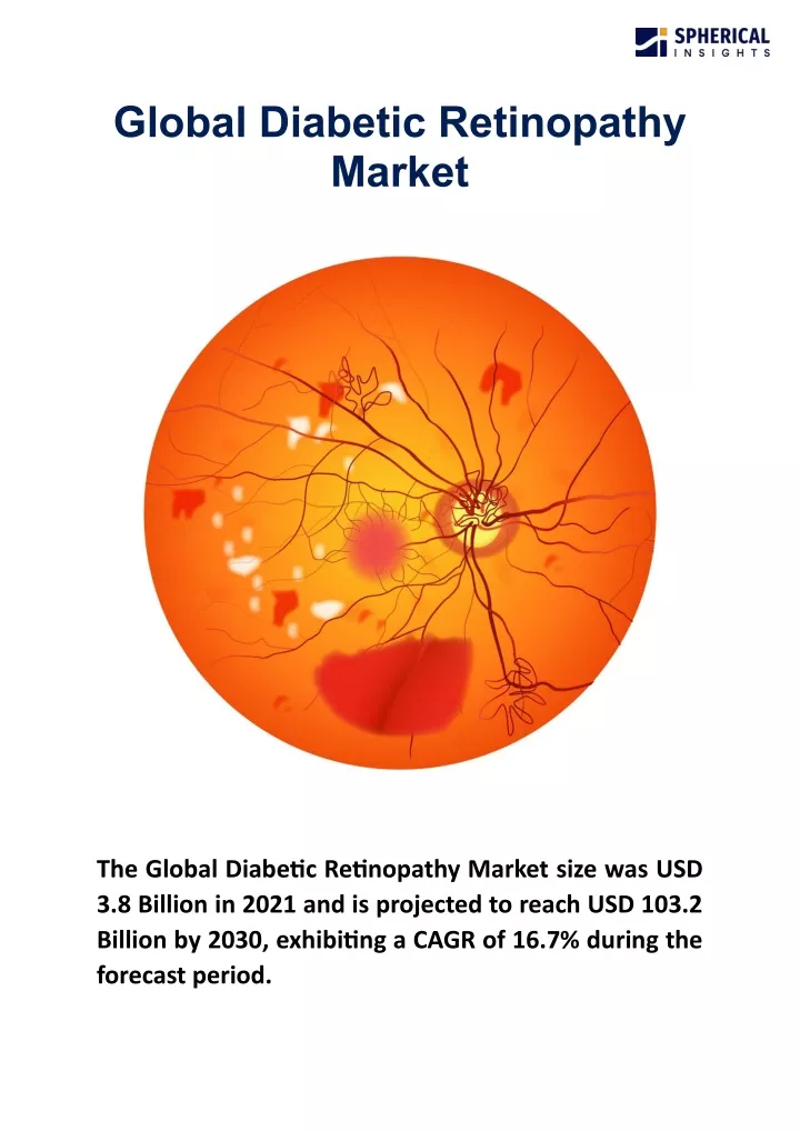 global diabetic retinopathy market