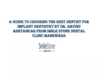 A Guide to Choosing the Best Dentist for Implant Dentistry
