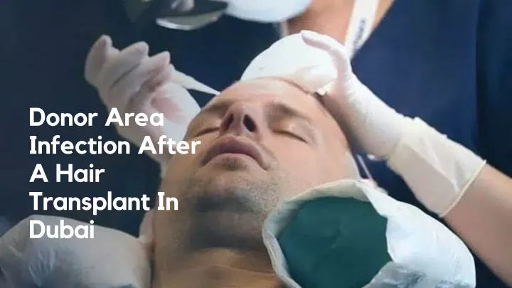 donor area infection after a hair transplant