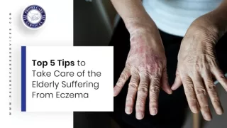 Top 5 Tips to Take Care of Elderly Suffering From Eczema
