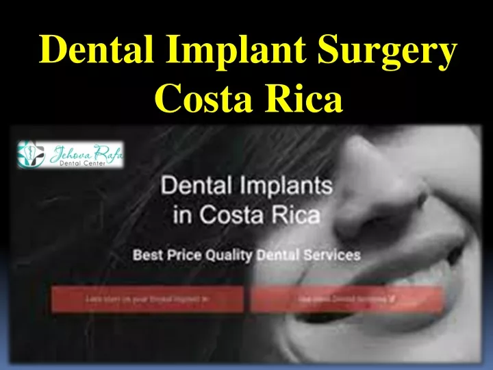 dental implant surgery costa rica