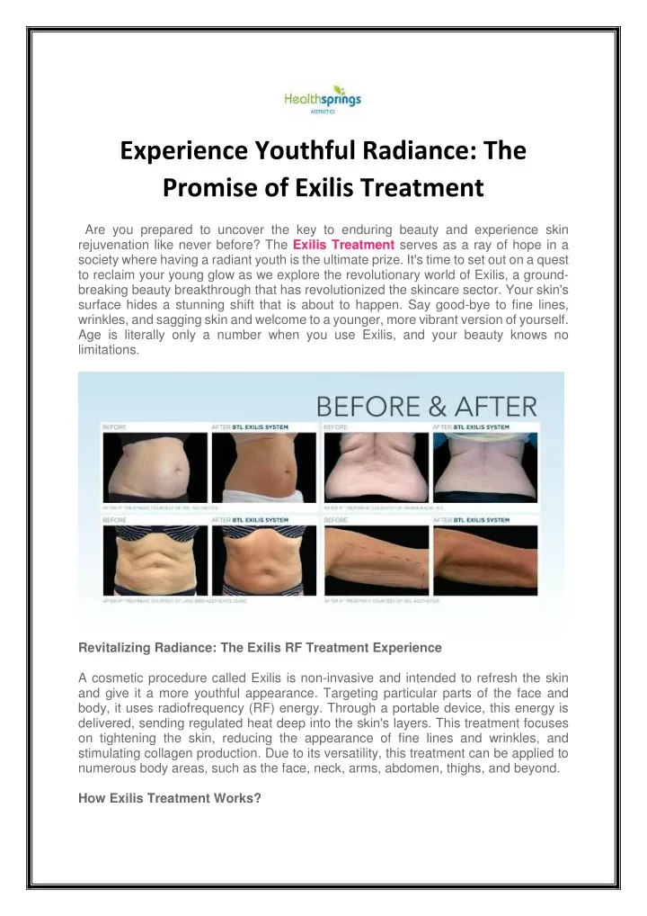 experience youthful radiance the promise