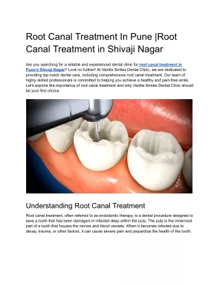 Root Canal Treatment In Pune _Root Canal Treatment in Shivaji Nagar