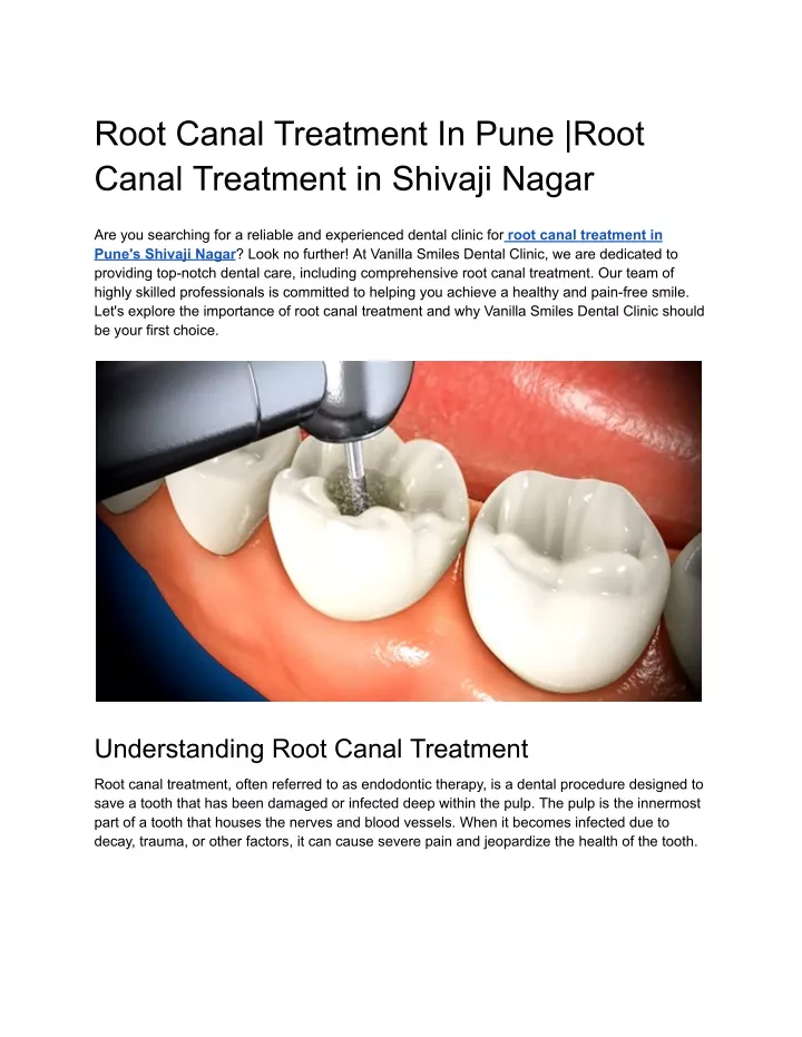 root canal treatment in pune root canal treatment