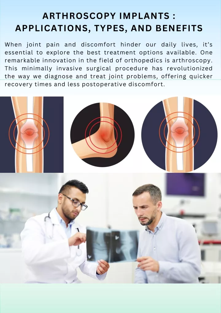 arthroscopy implants applications types