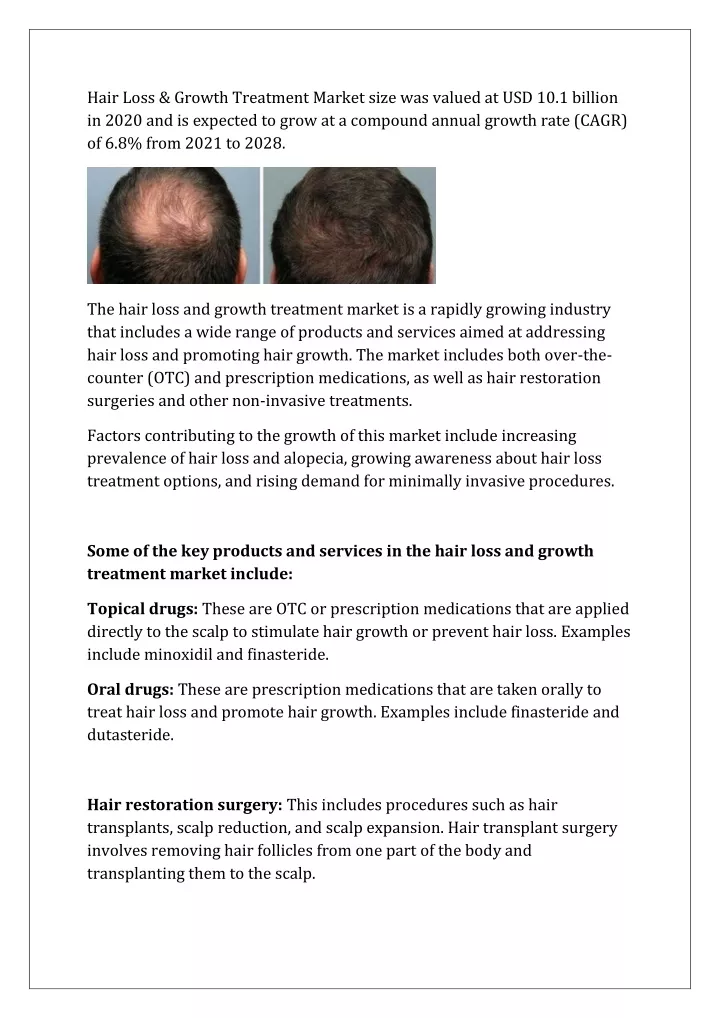 hair loss growth treatment market size was valued