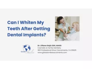 Can I Whiten My Teeth After Getting Dental Implants?