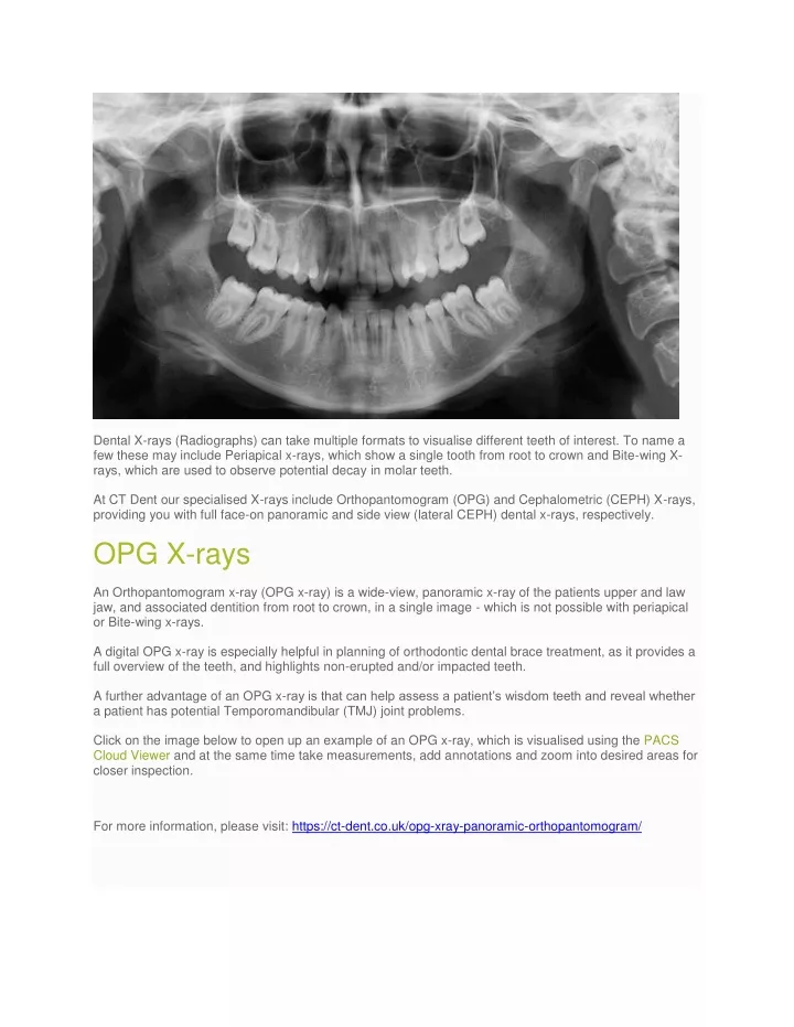 dental x rays radiographs can take multiple