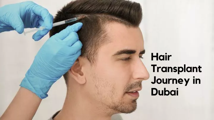 hair transplant journey in dubai