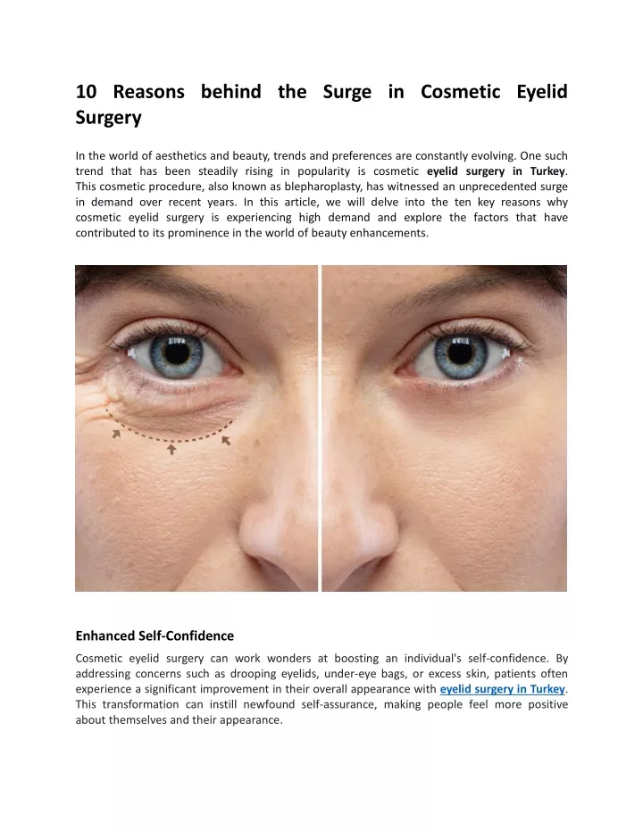 10 reasons behind the surge in cosmetic eyelid
