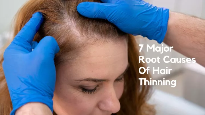 7 major root causes of hair thinning