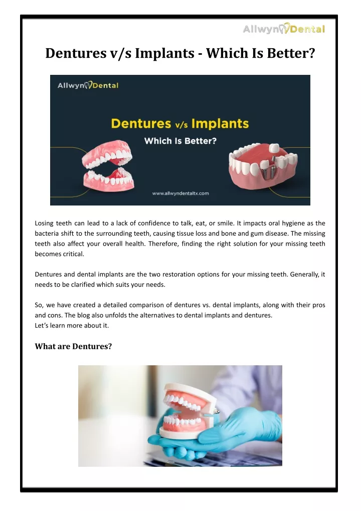 dentures v s implants which is better