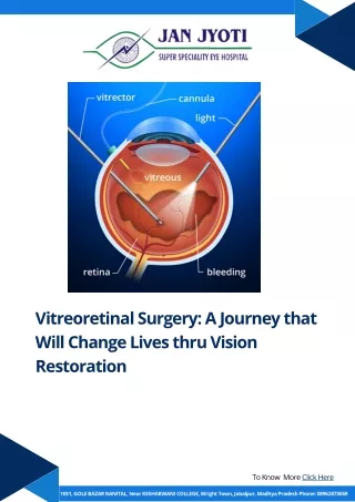Vitreoretinal Surgery A Journey that Will Change Lives thru Vision Restoration at jan jyoti eye hospital