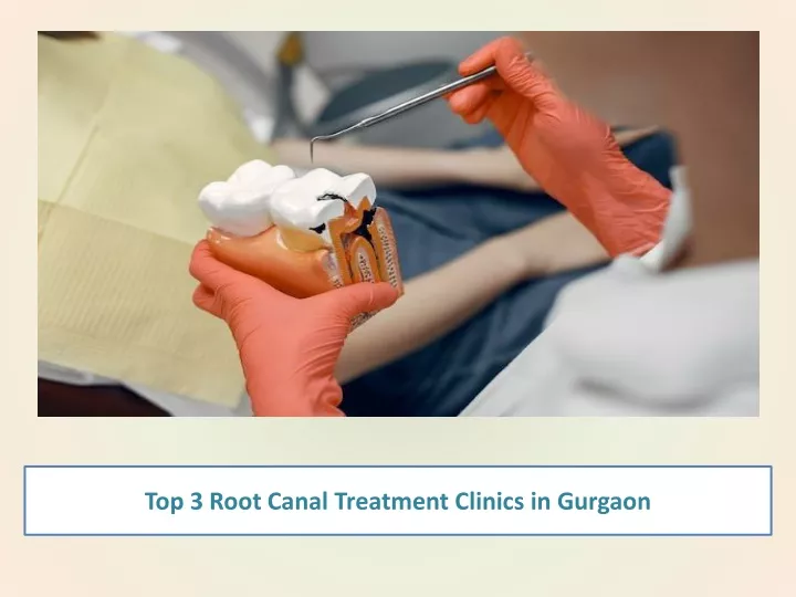 top 3 root canal treatment clinics in gurgaon