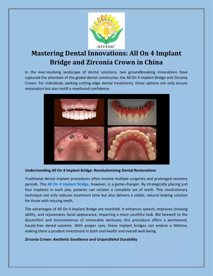 mastering dental innovations all on 4 implant