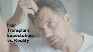 Hair Transplant Expectations vs. Reality