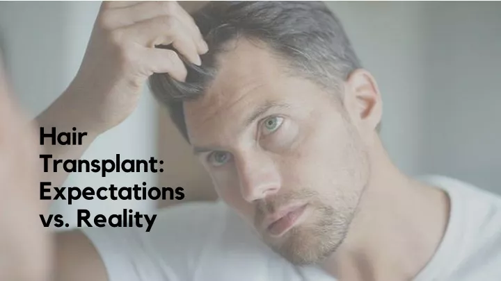 hair transplant expectations vs reality