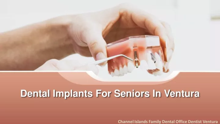 dental implants for seniors in ventura