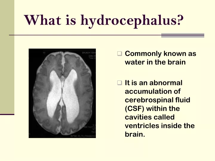 what is hydrocephalus