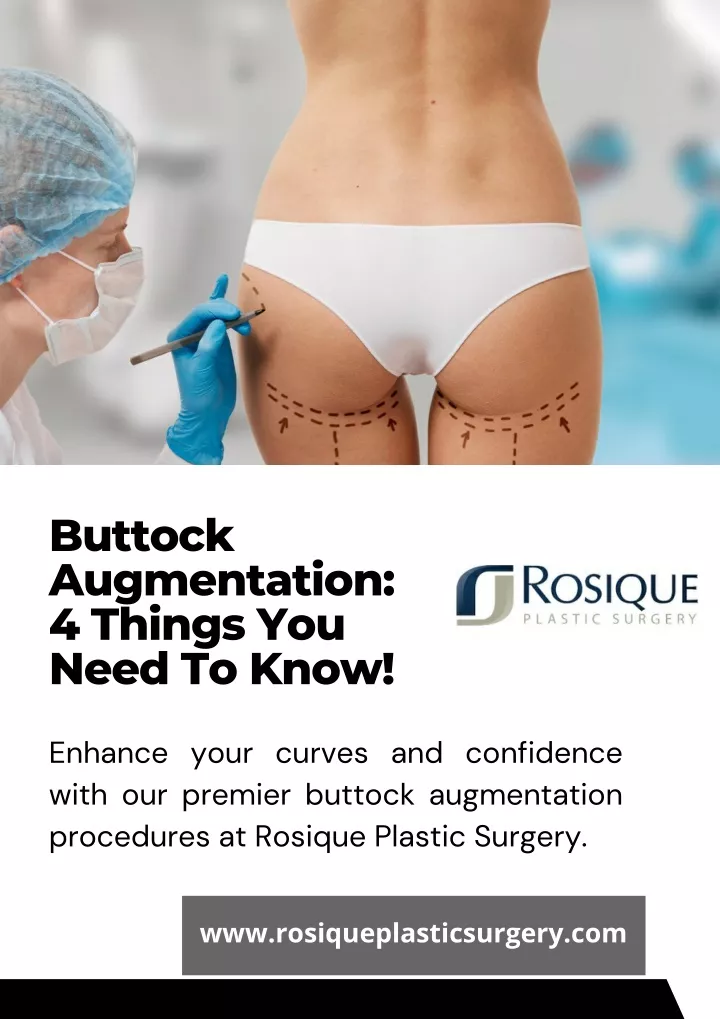 buttock augmentation 4 things you need to know