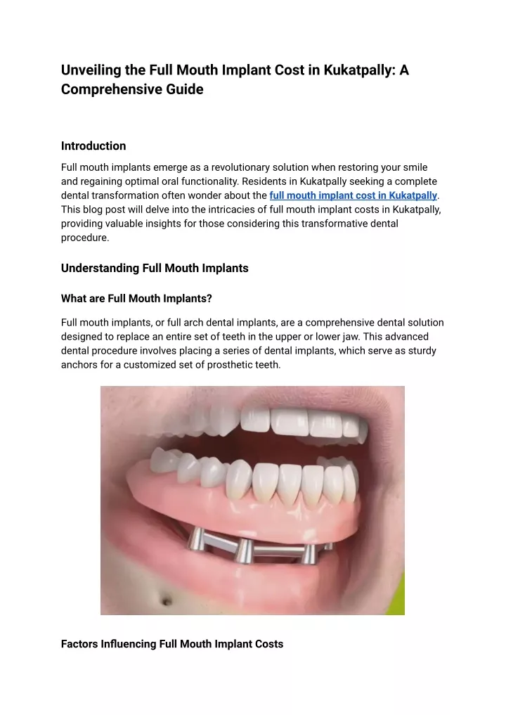 unveiling the full mouth implant cost