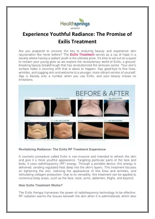 Experience Youthful Radiance: The Promise of Exilis Treatment