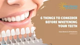 6 Things To Consider Before Whitening Your Teeth