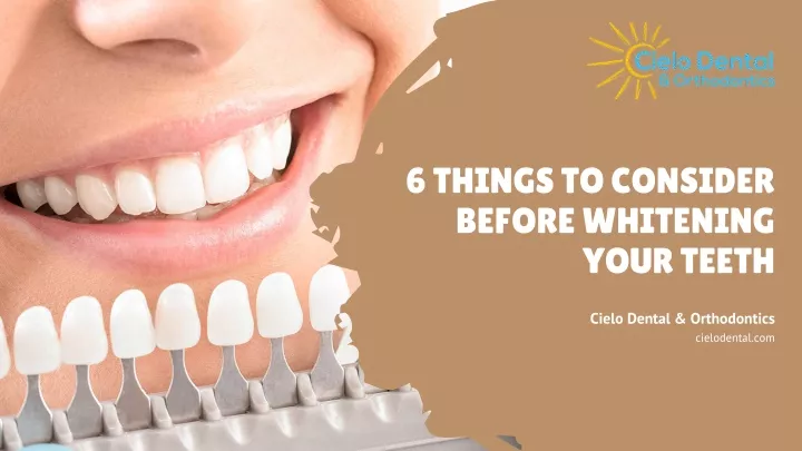 6 things to consider before whitening your teeth