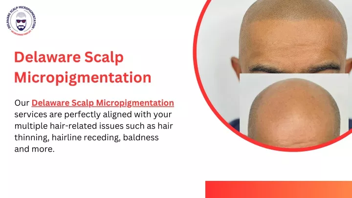 delaware scalp micropigmentation