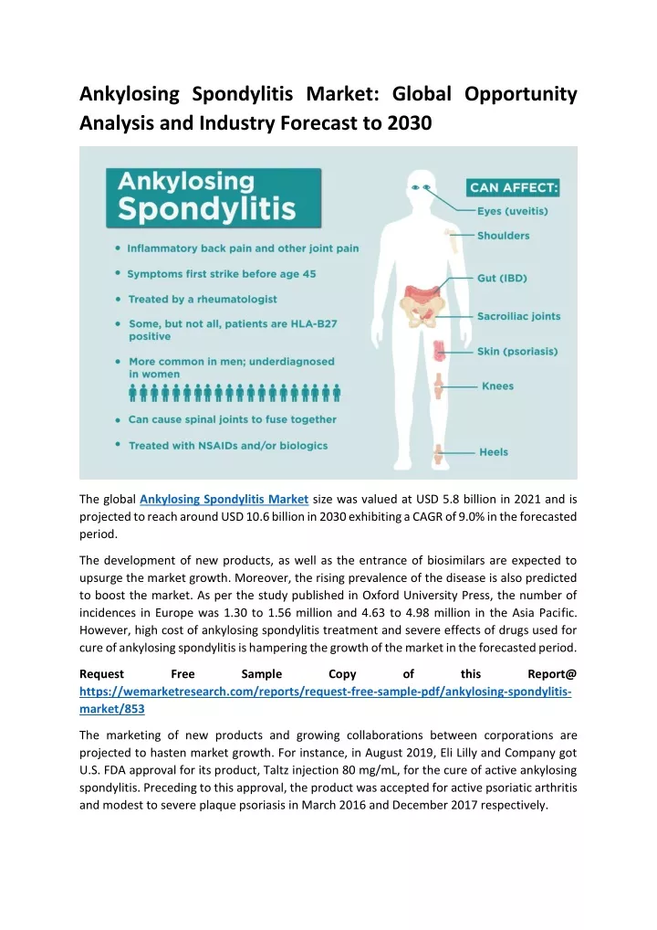 ankylosing spondylitis market global opportunity