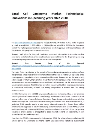 Basal Cell Carcinoma Market